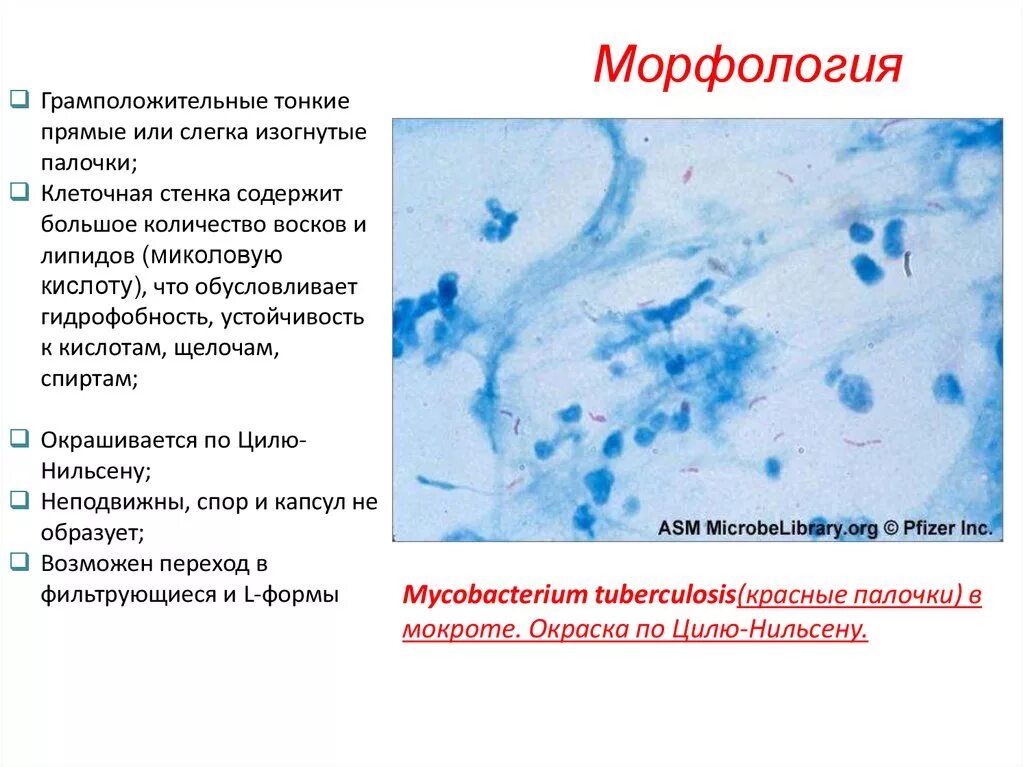 Микроскопия по Цилю Нильсену туберкулез. Мазок мокроты по Цилю-Нильсену. Окраска бактерий по Цилю-Нильсену. Микобактерии туберкулеза по Циля-Нильсена.