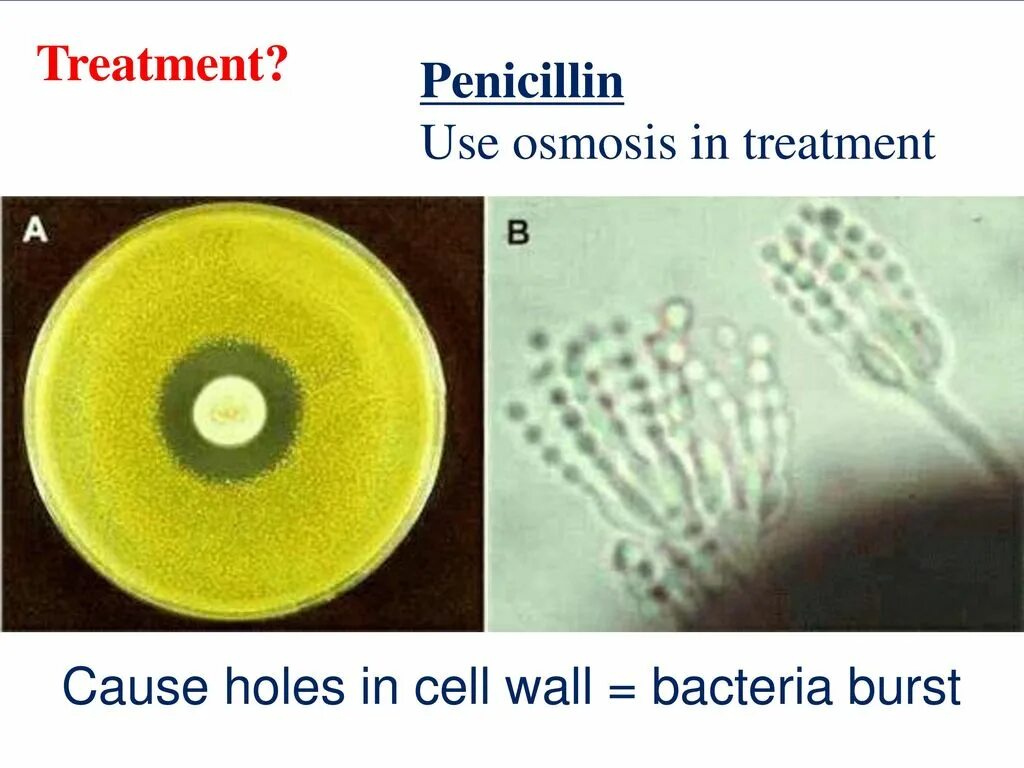 Плесень флеминга. Плесень пеницилл микроскоп. Пенициллин бактерии. Пенициллин антагонизм. Пеницилл и бактерии.