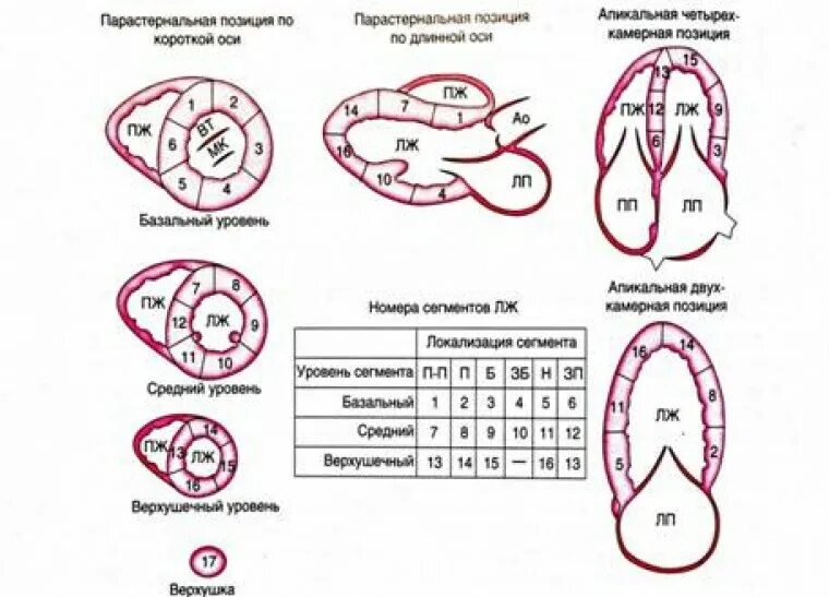 Сократимость лж. Зоны гипокинезии миокарда левого желудочка. Сегментарное строение миокарда ЭХОКГ. Сегменты левого желудочка ЭХОКГ схема. Сегменты левого желудочка по эхокардиографии.