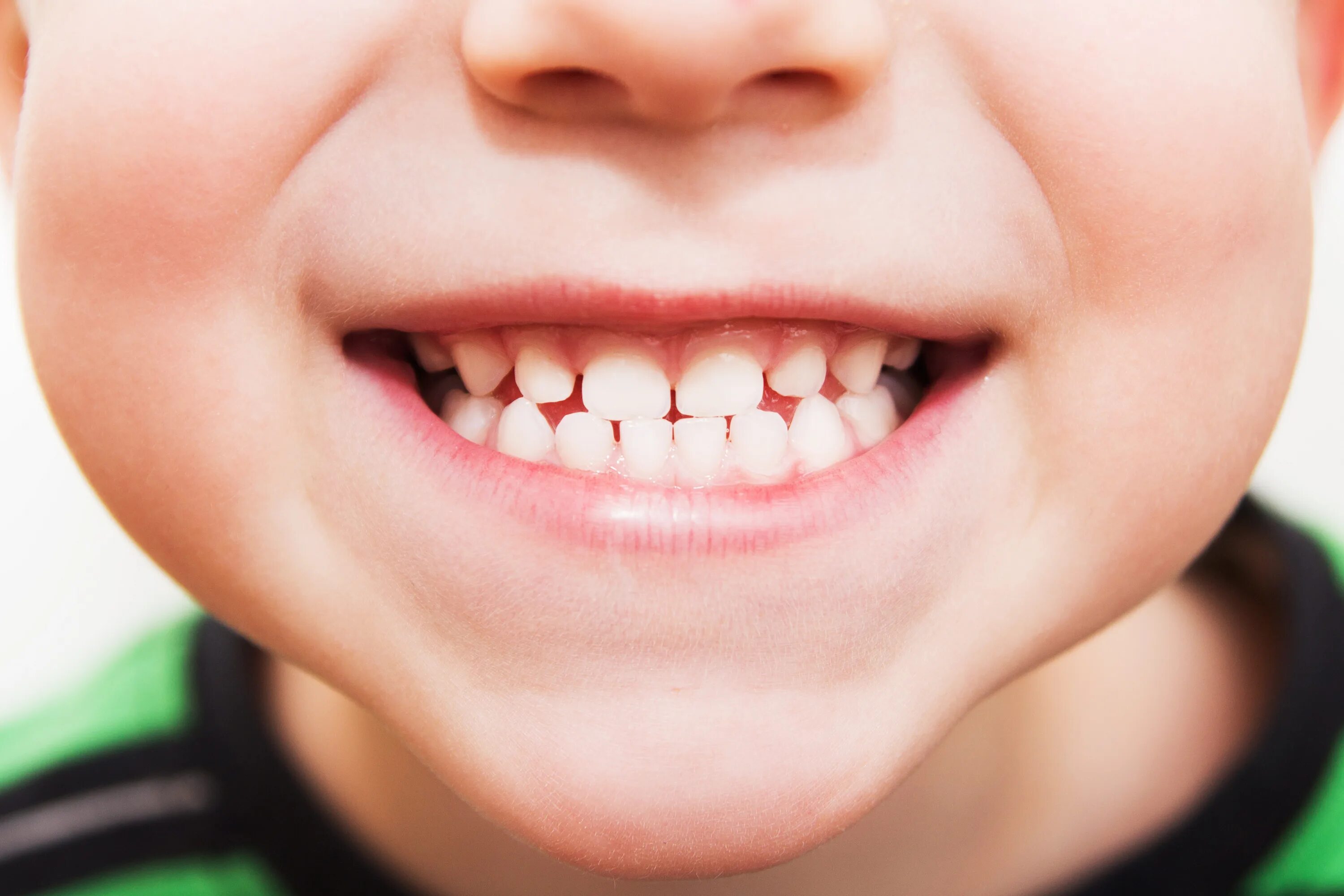 Красивые зубы у детей. Неправильный прикус у ребенка. Ровные зубы у детей. Зубы человека у детей