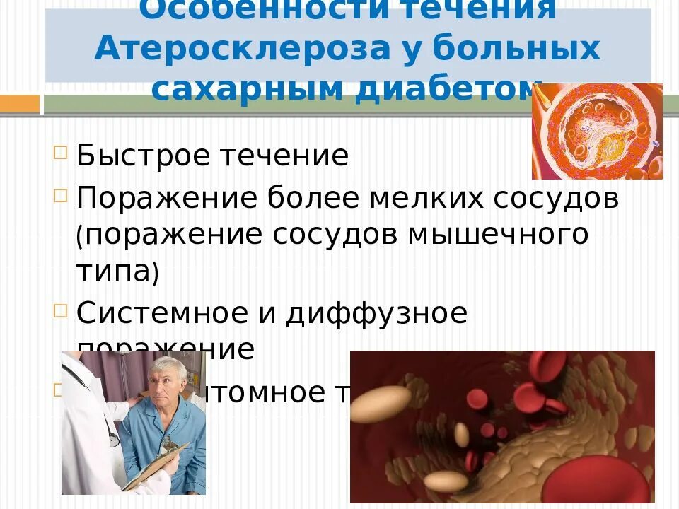 Атеросклероз особенности. Сахарный диабет презентация. диабет доклад. сахарный диабет доклад. презентация на тему атеросклероз.