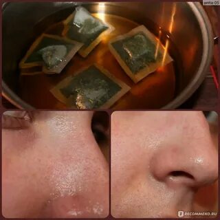 Сколько нужно распаривать лицо