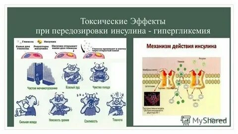 Синдром сомоджи