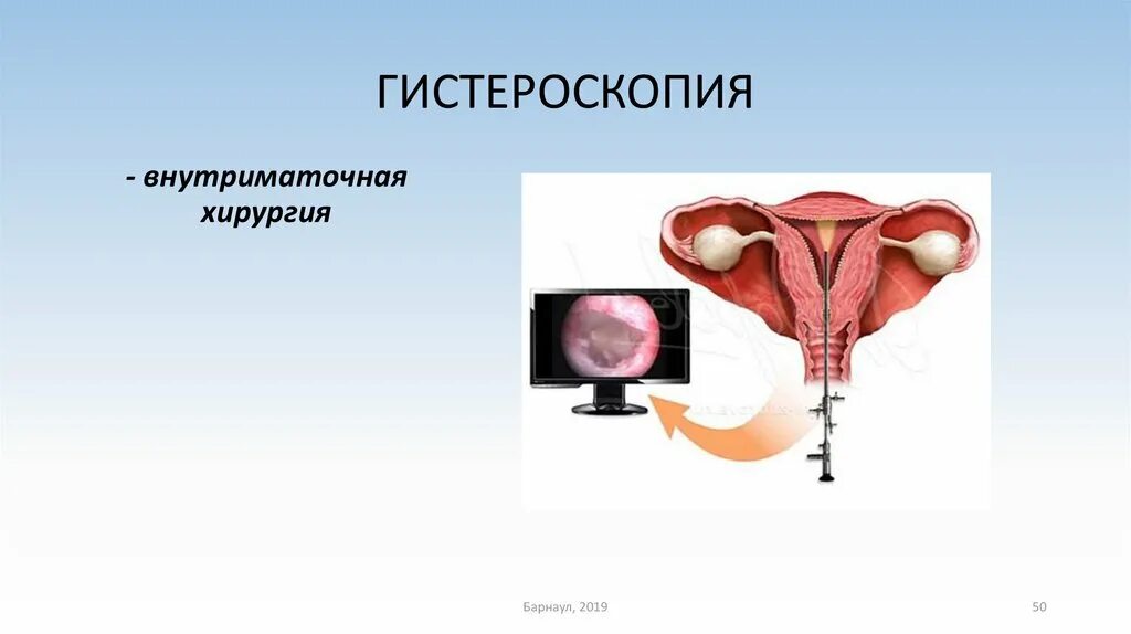 Гистероскопия в какой день цикла делать. Гистероскопия в гинекологии. двурогая матка гистероскопия. гистероскопия презентация.