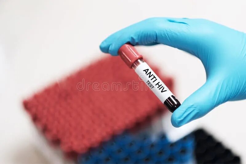 Маркеры ВИЧ инфекции в крови лаборатория. Кровь в СПИД лабораторию отправляется в. Продемонстрируйте забор крови на ВИЧ на фантоме.