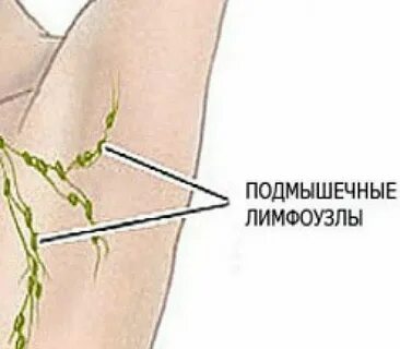 Лимфоузел под мышкой где находятся фото