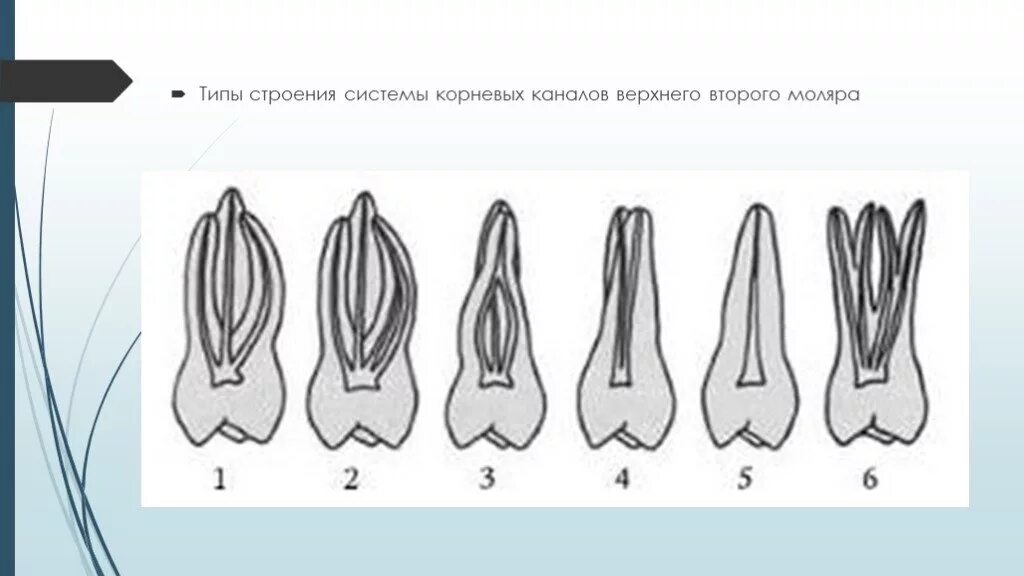 Анатомия корневых каналов верхнего второго моляра. 26 Зуб анатомия корневых каналов. Зуб 26 анатомия каналов анатомия корневых каналов.