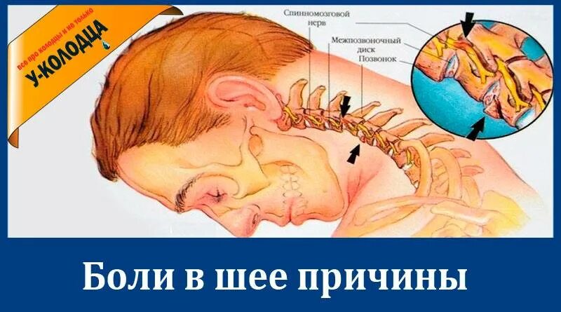Болит шея при поворотах врач. Плчемуболит шея. почему болит шея причины.