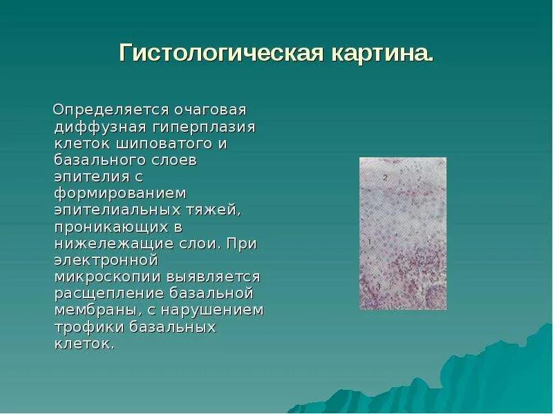 Диффузная гиперплазия что это