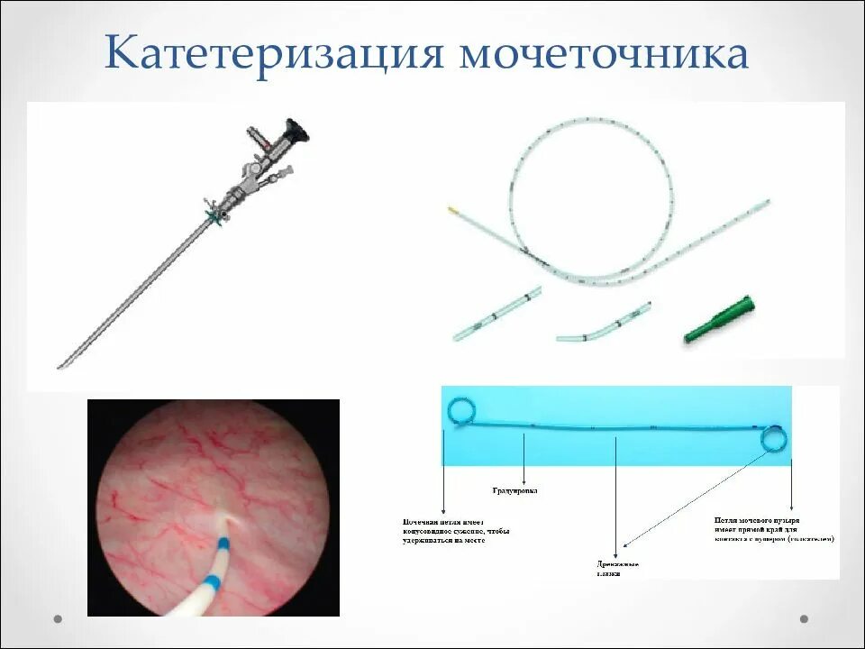 Катетер стент мочеточниковый. Введение катетера в мочеточник. Катетер стент почечный. Внутренний мочеточниковый катетер. Снятии стента