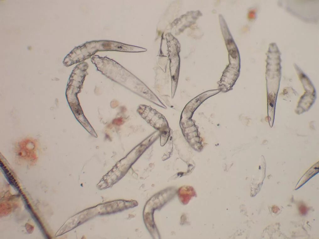 Клещи паразиты таблетки. Клещ демодекс Канис под микроскопом. Демодекс под микроскопом у собак. Кожный клещ Demodex folliculorum.