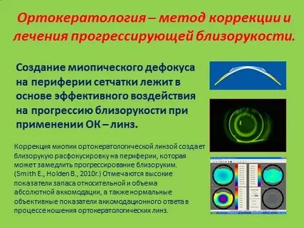 Прогрессирующая миопия