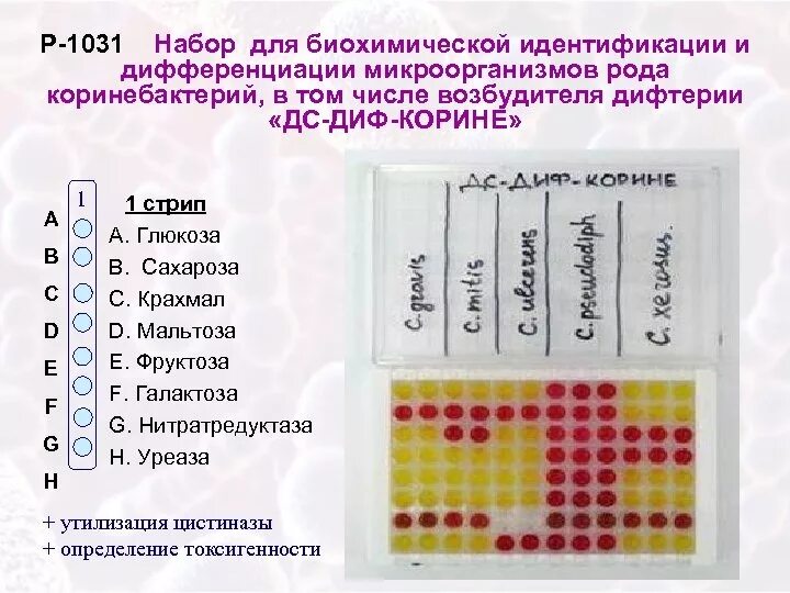 Тест система статья. Микротест-система для идентификации микроорганизмов. тест-системы для идентификации микроорганизмов. биохимические тесты для идентификации микроорганизмов. тест-система для биохимической идентификации бактерий.