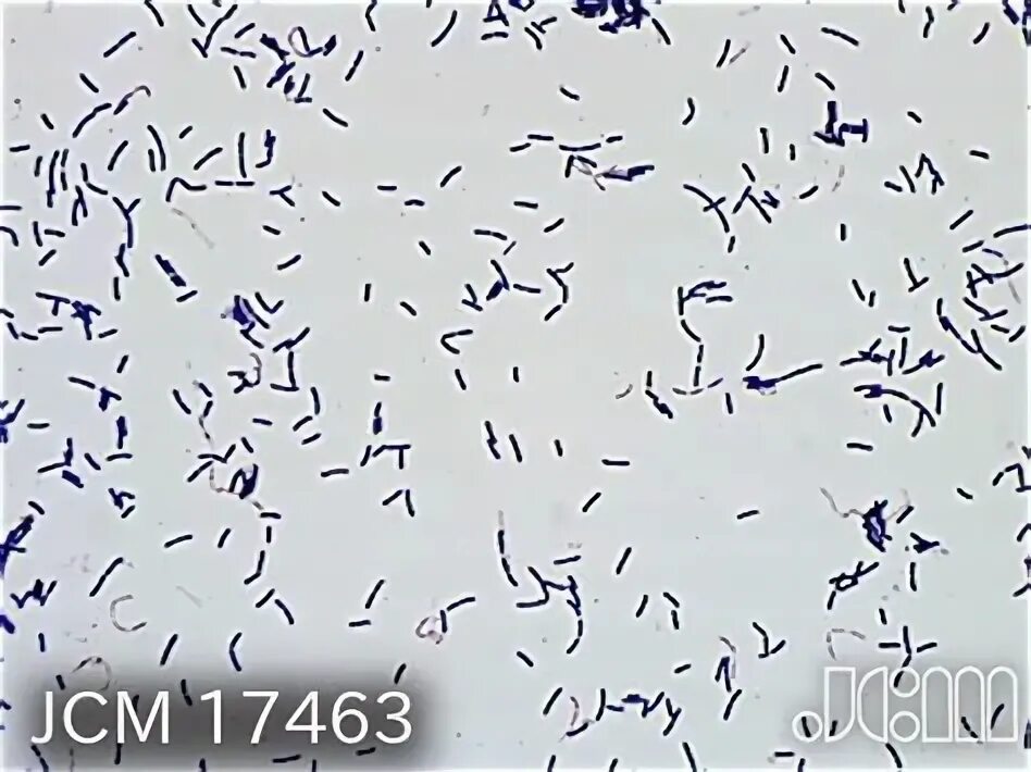 Eubacterium spp у женщин что это такое. Eubacterium spp у женщин что это такое