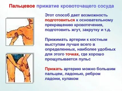 Способы остановки кровотечения пальцевое прижатие артерий