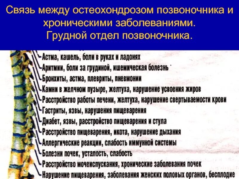 Можно ли мазать остеохондроз. Остеохондроз грудного отдела спереди. Остеохондроз грудного отдела симптомы. При остеохондрозе грудного отдела. Остеохондрома грудного отдела позвоночника.