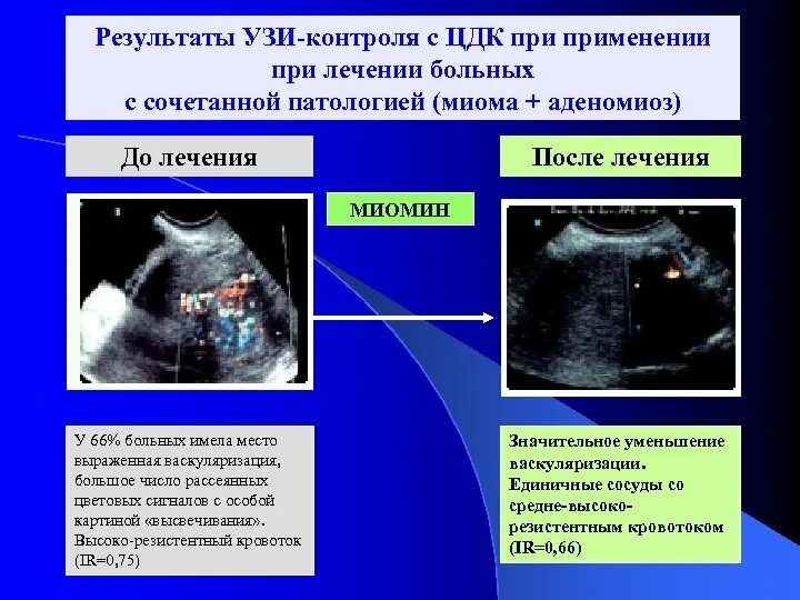 Как отличить на узи