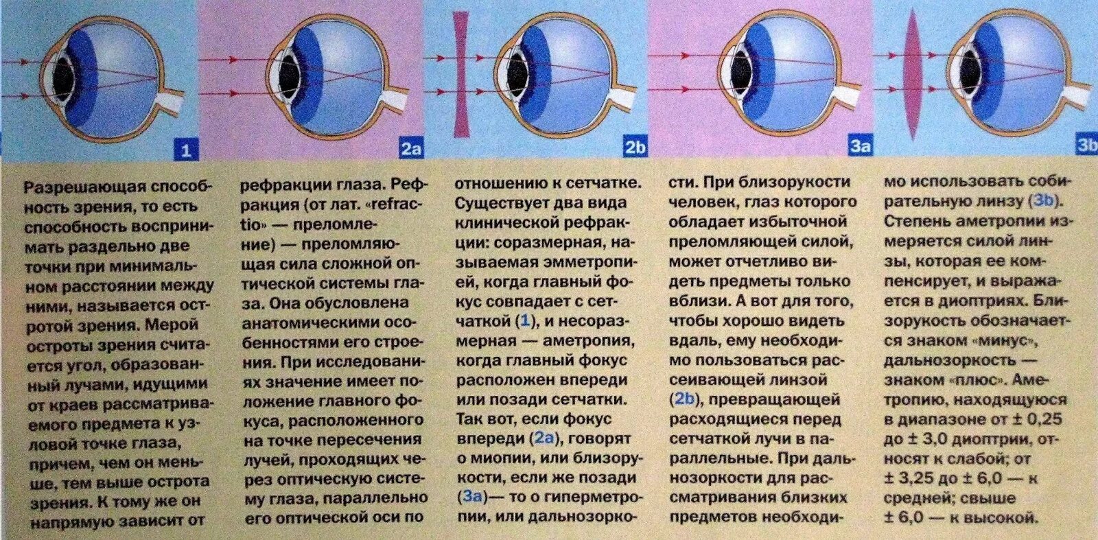 Изображение попадает если оно расположено впереди сетчатки. Миопия острота зрения. Рефракция при близорукости. При миопии главный фокус находится. При близорукости фокус за сетчаткой.