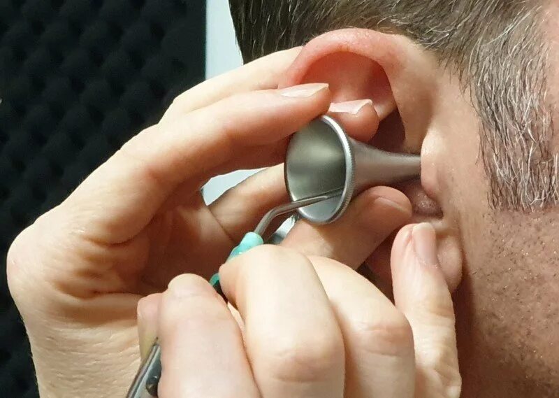 Ear wax. Ear wax. Серная пробка ватные палочки. Ear wax. Ear wax.