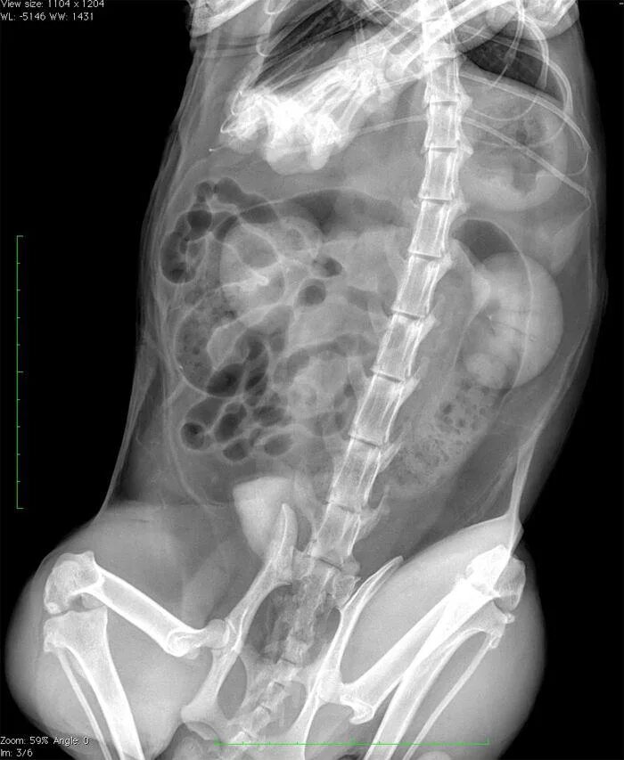 Рентген можно сделать. Обзорный рентген брюшной полости. Рентген брюшной полости с барием.