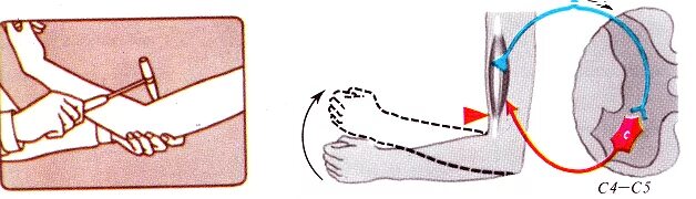 Сгибательно локтевой рефлекс. Локтевой сгибательный рефлекс физиология. Рефлекс локтевого сгибателя. Сгибательно локтевой рефлекс рефлекторная дуга. Дуга сгибательного рефлекса