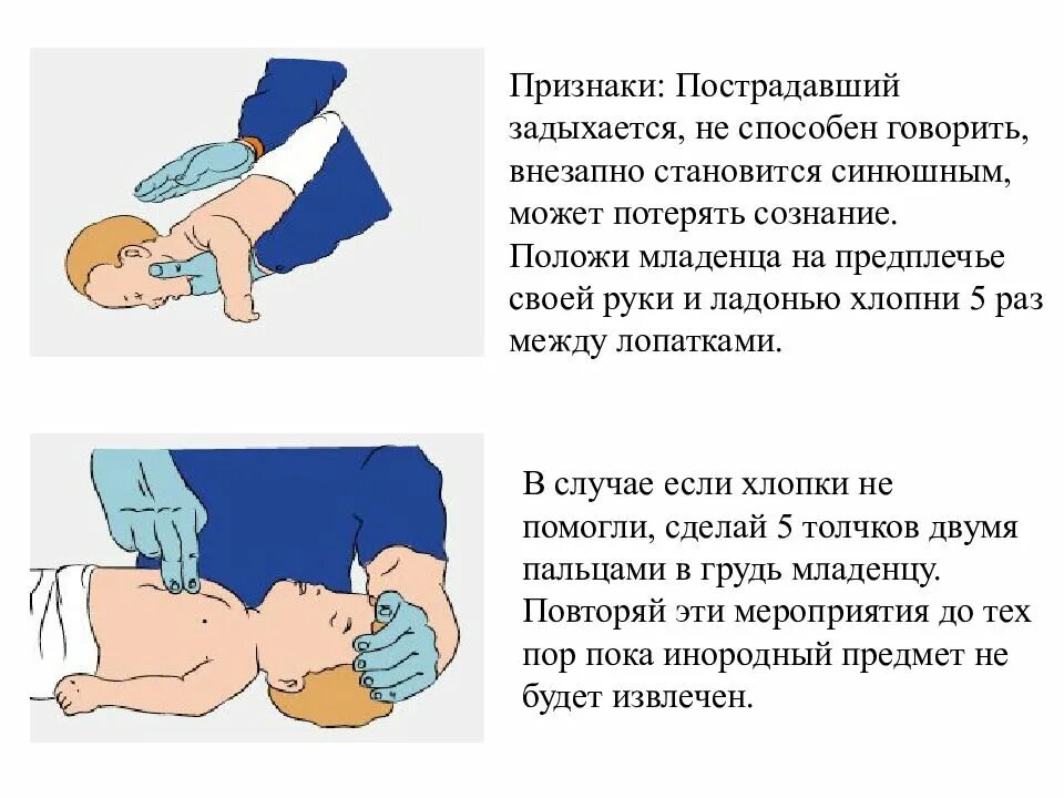 Первая помощь задыхающемуся. Первая помощь если человек подавился. если ребенок подавился первая помощь. первая помощь если человек подавился и задыхается. оказание первой помощи при подавился.