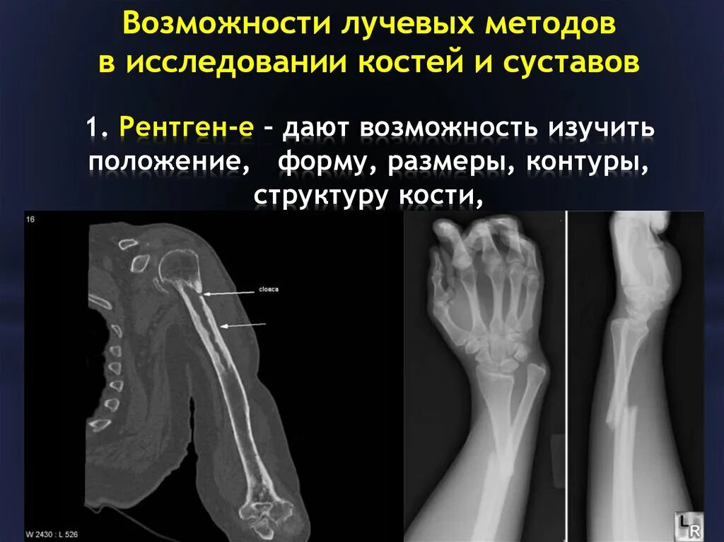 Рентгенологическое исследование. Рентгенологический симптом перелома кости. Рентгенологическому исследованию травмы. Рентгенологическому исследованию травмы. Рентгенологическое исследование суставов.
