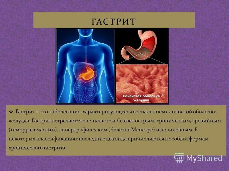 Как определить гастрит. Как определить гастрит