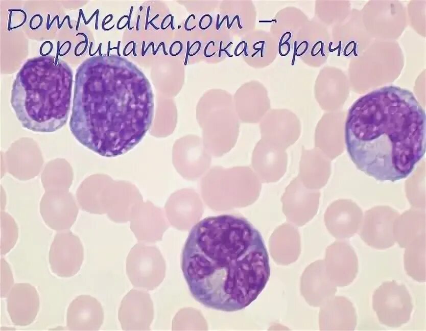 Гранулоциты макрофаги