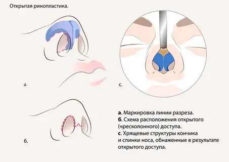 Как открыть нос