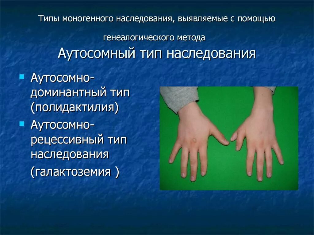 Типы моногенного наследования. Преаксиальная полидактилия.