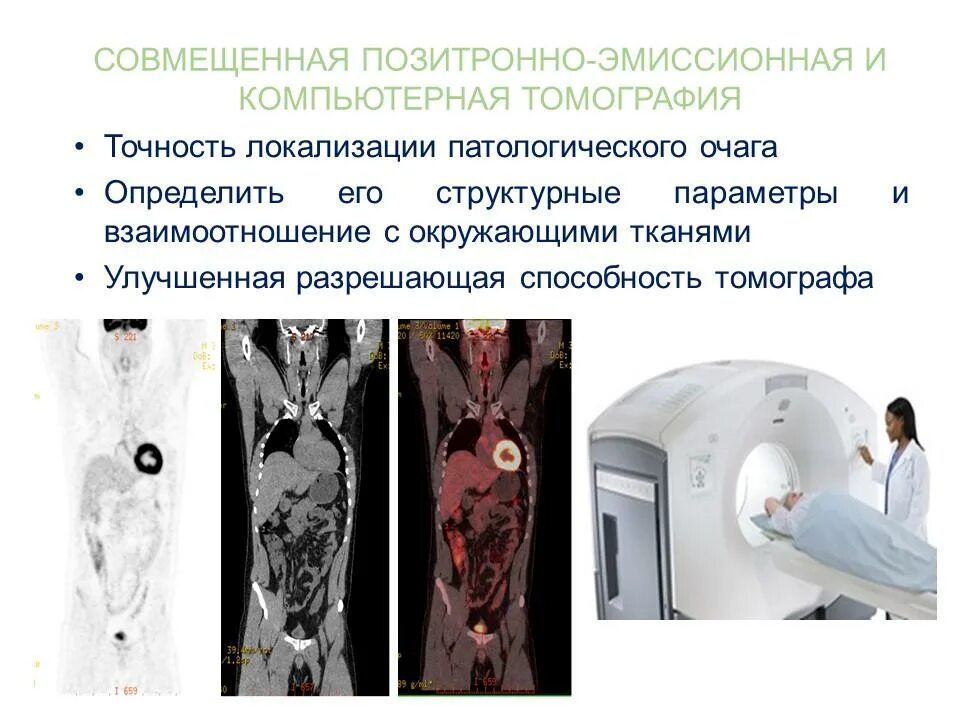 ПЭТ кт с контрастированием. Позитронно-эмиссионная томография опухоли. Позитрон-эмиссионная  томография: ПЭТ. Как пройти пэт кт