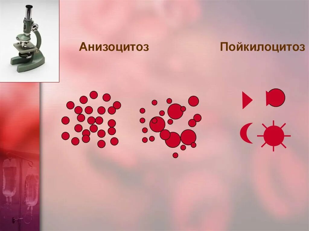 Пойкилоцитоз анемия. Анизоцитоз. Анизоцитоз и пойкилоцитоз. Анизоцитоз, пойкилоцитоз пойкилоцитоз. Антхоцитоз ройеилоциооз.