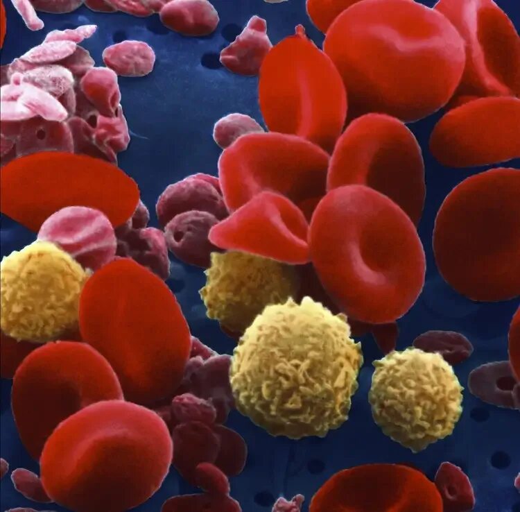 Место разрушения клеток крови. Эритроциты лейкоциты тромбоциты. Кровь лейкоциты тромбоциты. Лейкоцит и эритроцит клетки. Эритроциты и лейкоциты в крови.