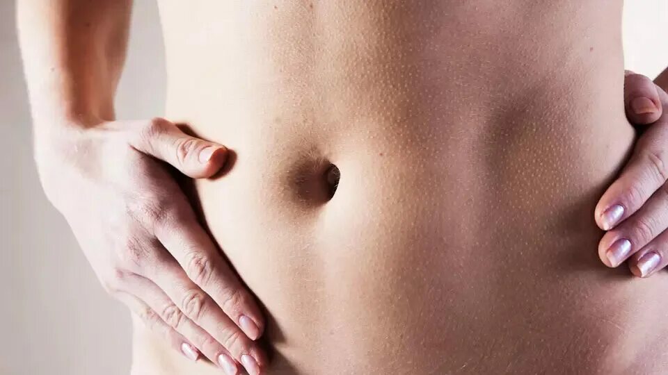 герниография пупочная грыжа. симптомы паховой грыжи у женщин. паховая и пупочная грыжа у детей. причины паховых грыж у детей. паховая грыжа у женщин симптомы.