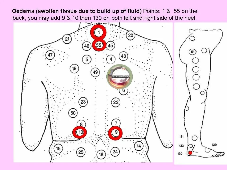 Банки на печень. Точки хиджама атлас точек. Схема хиджама точки. Хиджама атлас точек для женщин. Атлас хиджама точки хиджама.