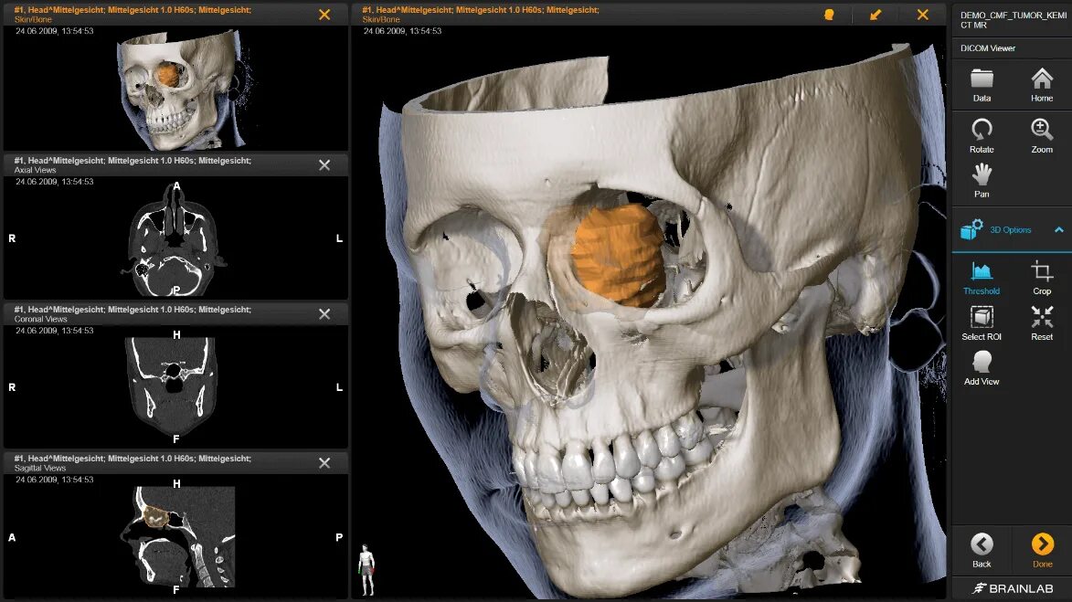Dicom viewer. Multivox dicom viewer. dicom объемное изображение. dicom 3d viewer free.