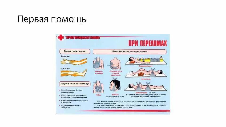 Переломы вывихи ушибы первая медицинская помощь. Виды переломов и первая помощь. оказание первой медицинской помощи при переломах. первая помощь переломы плакаты. переломы виды переломов первая помощь.