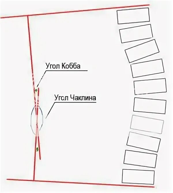Измерение угла сколиоза по чаклину. Углы сколиоза по коббу и по чаклину. Измерение угла Кобба. Угол сколиоза по коббу рентген. Угол кобба