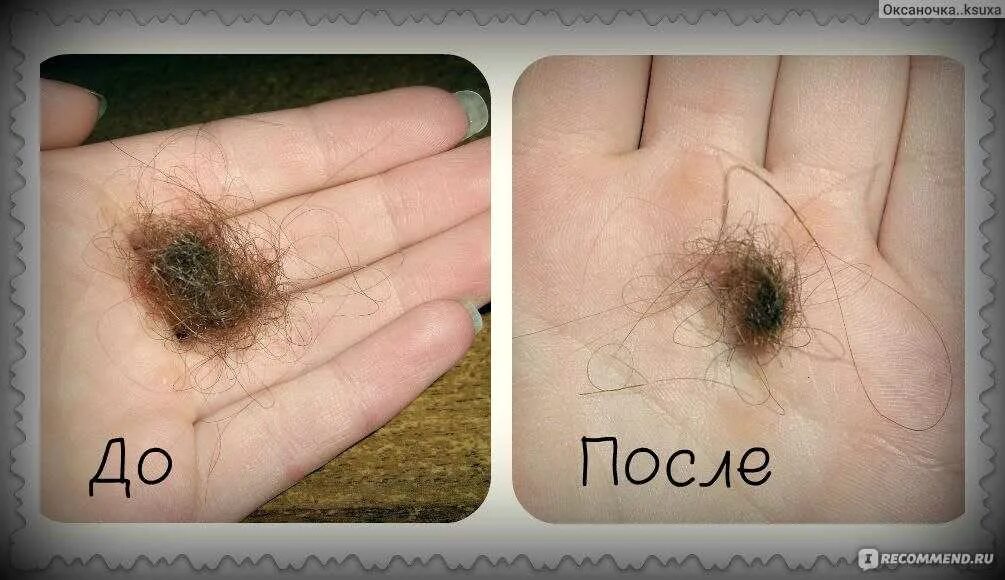 Сколько в норме выпадает