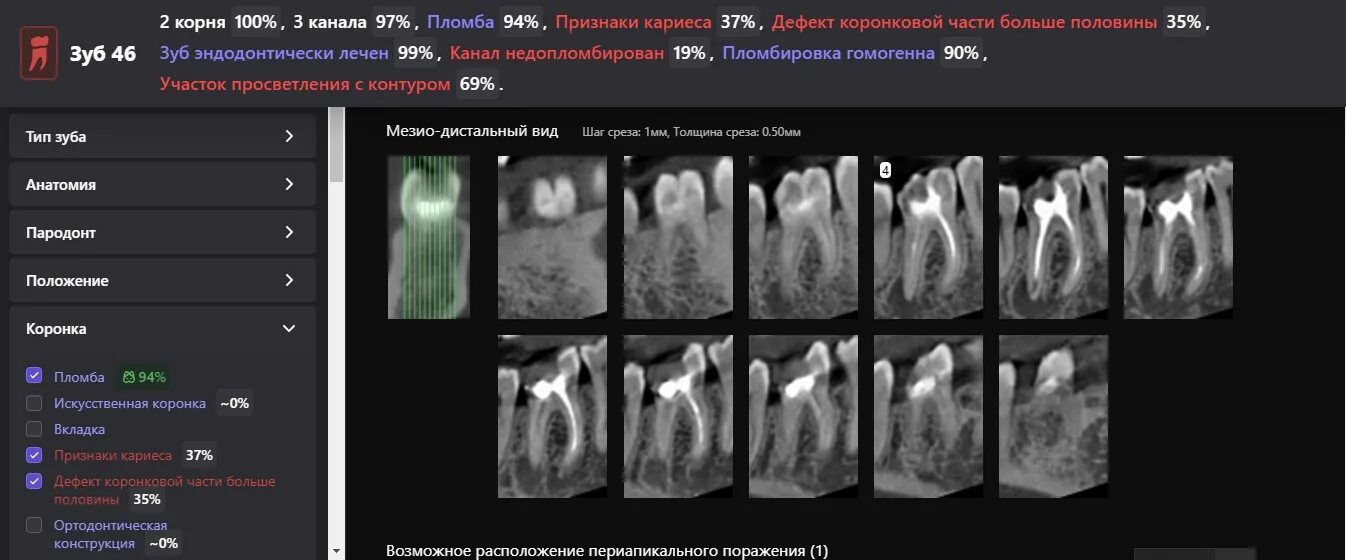 Сделать кт зубов в ульяновске недорого. Кт зубов.