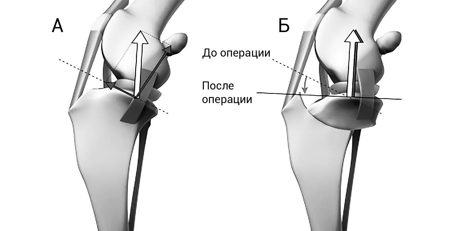 ПКС У собаки операция TPLO.