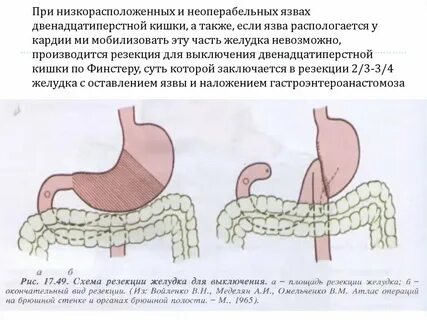 Болезни после операции