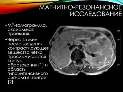 Магнитно резонансное исследование