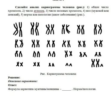 Человеку какого пола принадлежит данная кариограмма