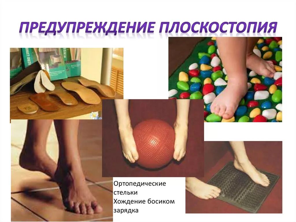 Плоскостопие может быть предотвращено. Профилактика при плоскостопии у детей. упражнения по профилактике плоскостопия в младшей группе. плоскостопие у детей дошкольного возраста лечение профилактика. причины плоскостопия у детей дошкольного возраста.