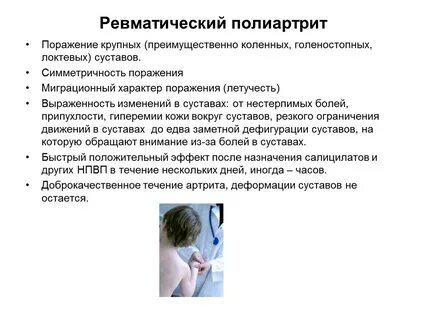 Полиартрит что это такое простыми словами