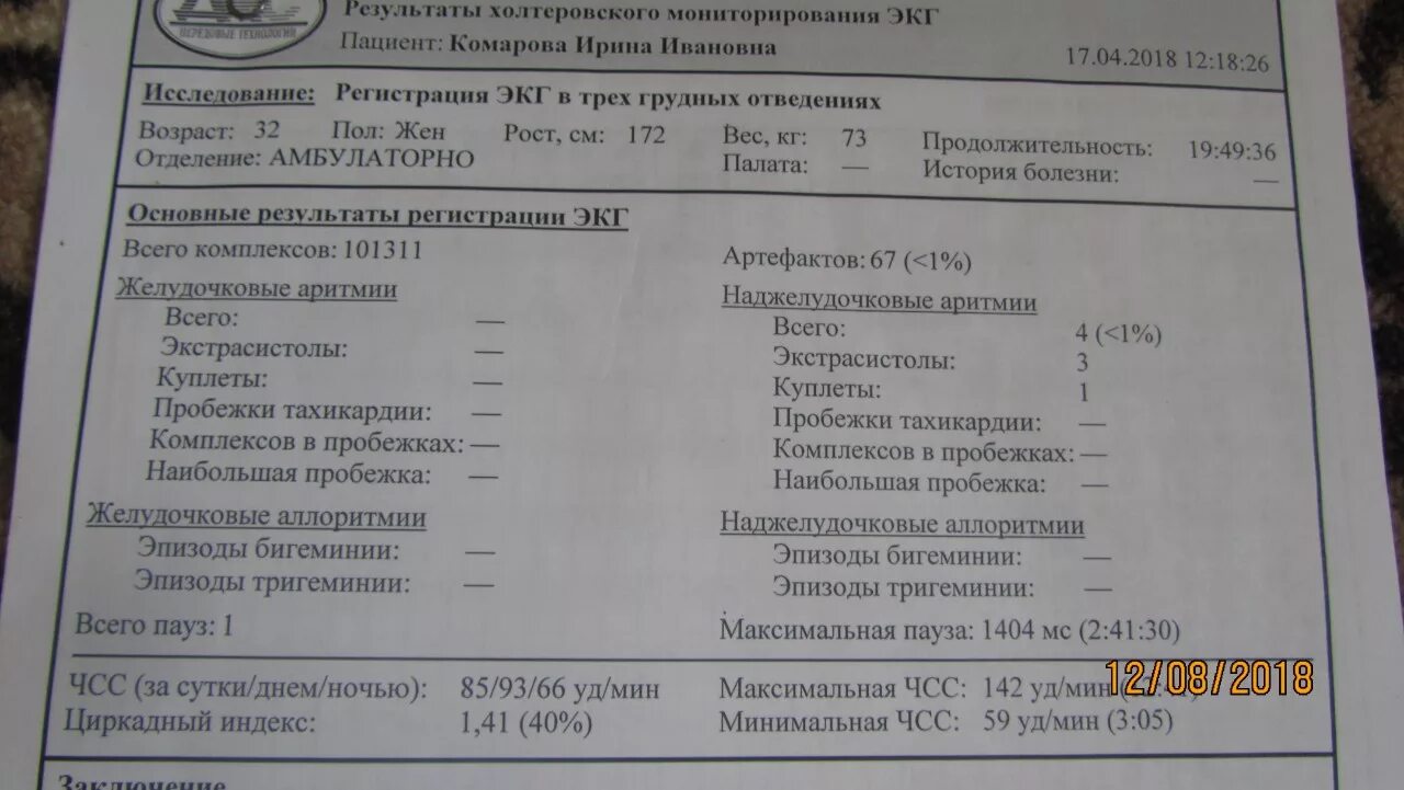 Сколько экстрасистол норма