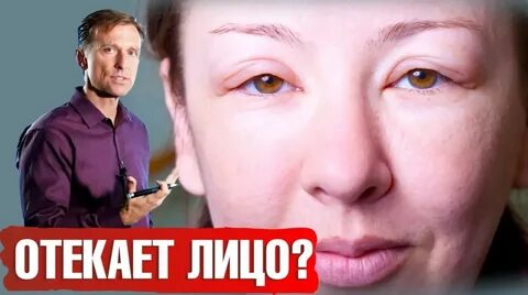 Как убрать отечность с лица после запоя