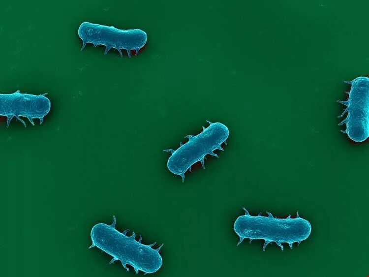 Salmonella enterica. Сальмонелла bongori. Палочка сальмонеллы. Сальмонелла Тифи микробиология. Salmonella Typhimurium возбудитель.